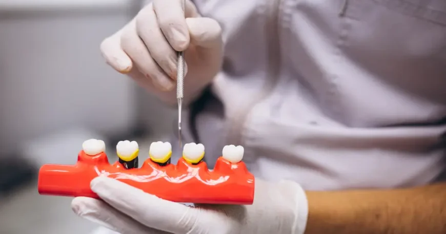 سعر الطربوش البورسلين - ابتسامة مثالية بتكلفة معقولة