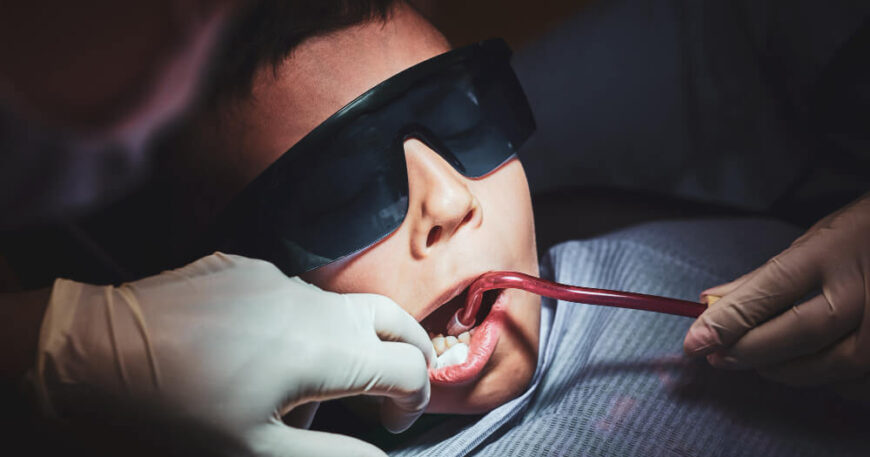 اسعار حشو العصب بالليزر الأمامي والخلفي اختلاف التكلفة