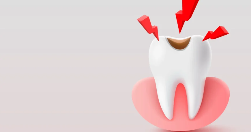 اضرار تمويت عصب الضرس - متى يكون سحب العصب ضرورياً؟