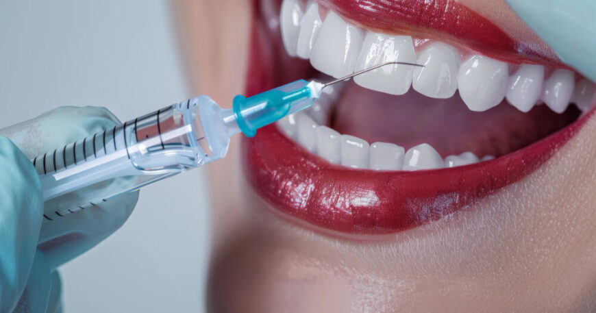 سعر الحشوات التجميلية لسد الفراغات بناءً على عدد الفراغات