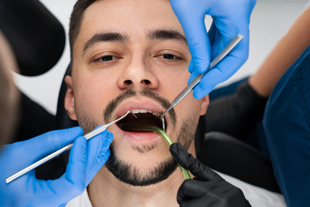 علاج الفراغات بين الضروس