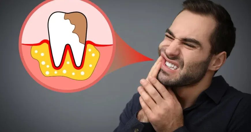 كم سعر تنظيف الاسنان من الجير؟ تحليل عوامل التكلفة