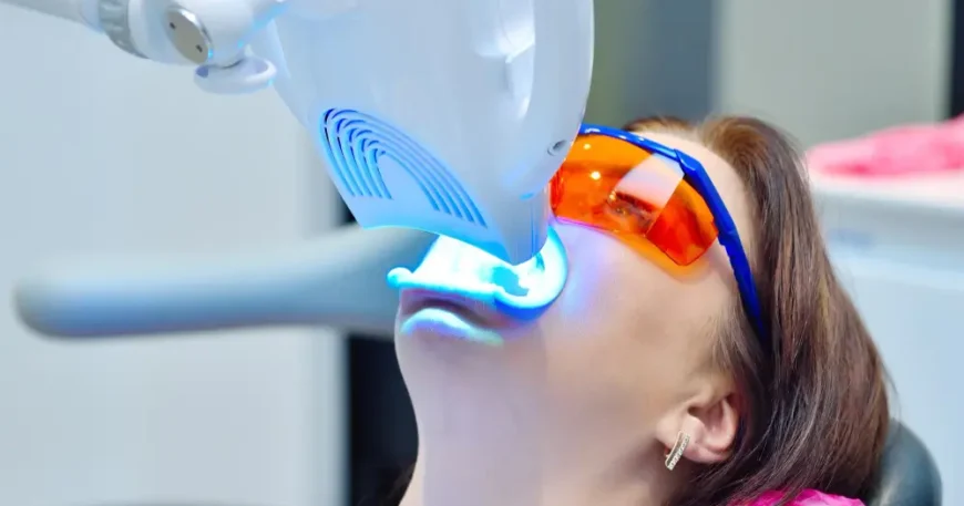 أفضل أنواع تبييض الأسنان بالليزر - تقنية الزووم