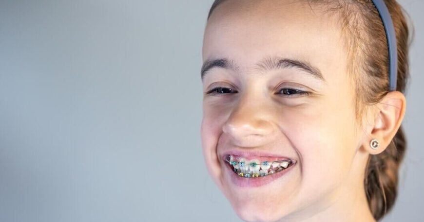 افضل سن لتركيب تقويم الاسنان للأطفال والبالغين 2026