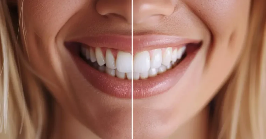الفرق بين تبييض الأسنان بالليزر والزوم - أيهما الأفضل لك؟