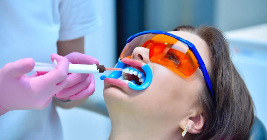 الممنوعات بعد تبييض الاسنان بالليزر - دليل النظام الغذائي