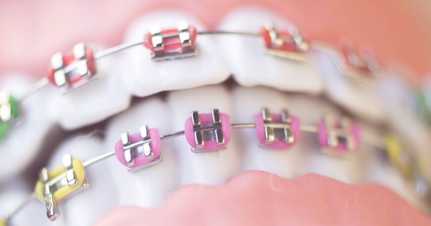 ترشيحات افضل دكاترة تقويم الاسنان في مصر (عن تجربة)