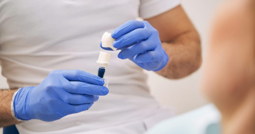 دليلك لاختيار افضل دكتور زراعة اسنان في القاهرة لعام 2026