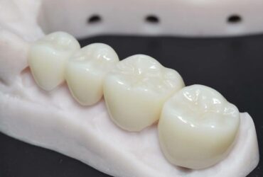 سعر الطربوش البورسلين للأسنان - هل هو الأنسب لك؟