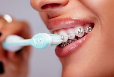 كيفية المحافظة على تقويم الاسنان - دليل العناية الشامل 2026