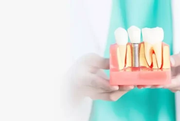 تجربتي مع زراعة الاسنان - القصة الكاملة من الألم للنجاح تجربتي مع زراعة الاسنان - القصة الكاملة من الألم للنجاح