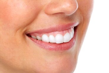 الضحكة اللثوية - حلول سريعة بدون جراحة (بوتكس وليزر)