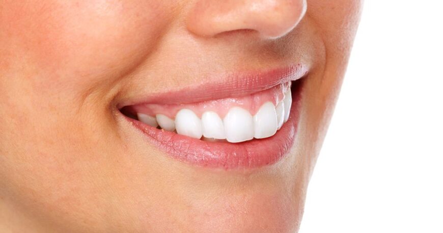 الضحكة اللثوية - حلول سريعة بدون جراحة (بوتكس وليزر)